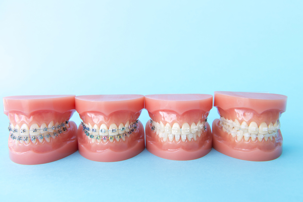 歯科矯正治療の基礎　混合歯列期を中心に