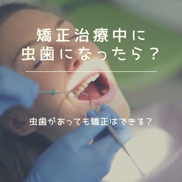 矯正治療中に虫歯になったら？虫歯があっても矯正はできる？